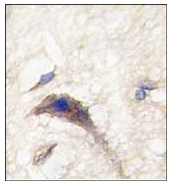 AP12338PU-N - DAAM1
