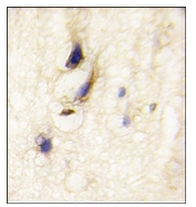 AP12339PU-N - DAAM1