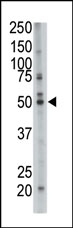 AP12194PU-N - Squalene synthetase