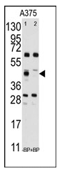 AP12195PU-N - Squalene synthetase