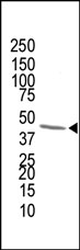 AP12197PU-N - FPP synthetase