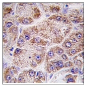 AP12197PU-N - FPP synthetase
