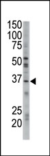 AP12198PU-N - GGPP synthetase