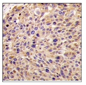 AP12198PU-N - GGPP synthetase