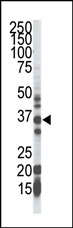AP12199PU-N - GGPP synthetase