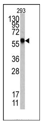 AP12213PU-N - Heat shock factor 1 / HSF1