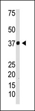 AP12219PU-N - NFKBIA / IKBA