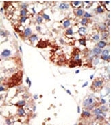 AP12224PU-N - NUB1