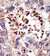 AP12236PU-N - CBX8