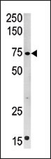 AP12254PU-N - CPT2