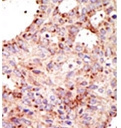 AP12128PU-N - ARFGAP1