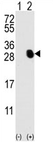 AP11850PU-N - Osteocalcin