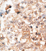 AP11850PU-N - Osteocalcin