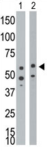 AP11858PU-N - CD292 / BMPR1A