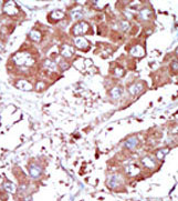 AP11858PU-N - CD292 / BMPR1A