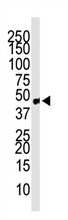 AP11869PU-N - CCBP2