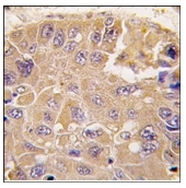 AP12163PU-N - METAP2