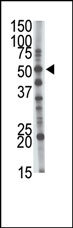 AP12174PU-N - GCNT1 / NACGT2