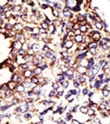 AP12174PU-N - GCNT1 / NACGT2