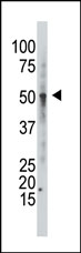 AP12175PU-N - GCNT1 / NACGT2