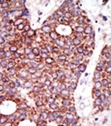 AP12175PU-N - GCNT1 / NACGT2