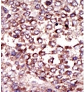 AP12184PU-N - Ribophorin-2 / RPN2
