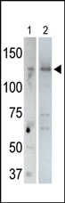 AP12046PU-N - USP25