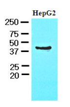 AM09070PU-N - CHI3L1