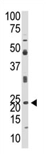 AP11890PU-N - Neurogenin 1