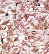 AP11890PU-N - Neurogenin 1