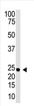 AP11894PU-N - Neurogenin-3