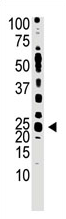 AP11913PU-N - TDGF1 / CRIPTO
