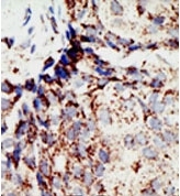 AP12077PU-N - BAP1