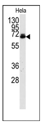 AP12092PU-N - Ubiquilin-1 / Ubiquilin-2