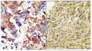 AP12092PU-N - Ubiquilin-1 / Ubiquilin-2