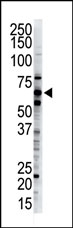 AP12093PU-N - Ubiquilin-2 (UBQLN2)
