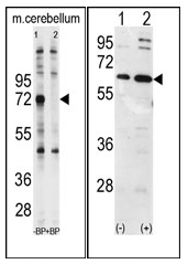 AP12094PU-N - Ubiquilin-1 (UBQLN1)