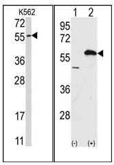 AP12095PU-N - Ubiquilin-1 (UBQLN1)
