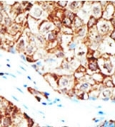 AP12095PU-N - Ubiquilin-1 (UBQLN1)