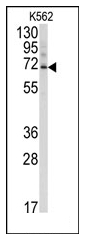 AP12096PU-N - Ubiquilin-3 (UBQLN3)