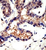 AP12096PU-N - Ubiquilin-3 (UBQLN3)