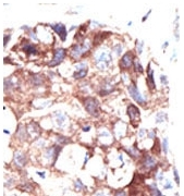 AP12100PU-N - Ubiquilin-1 (UBQLN1)