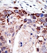 AP12104PU-N - Ataxin-3