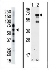 AP12106PU-N - Epsin-2