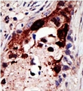 AP12106PU-N - Epsin-2