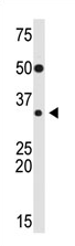 AP11930PU-N - SNAI2 / SLUG
