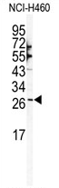 AP11933PU-N - SNAI1