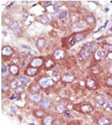 AP11968PU-N - UBE2D1 / SFT