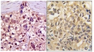 AP11969PU-N - UBE1 / UBA1