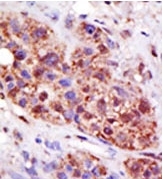 AP11973PU-N - UBE2B / RAD6B